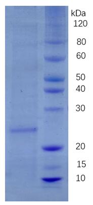 SDS-PAGE analysis of purified human ZNT-8.
